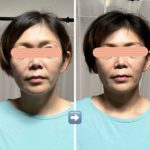 ビフォーアフター