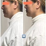 ビフォーアフター