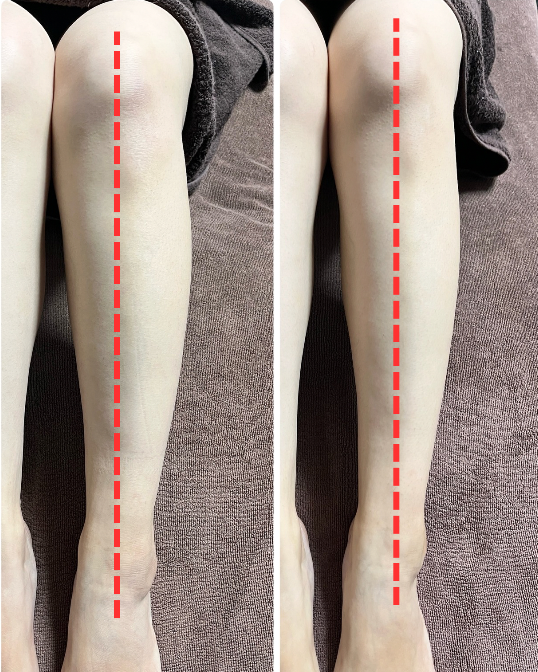 ビフォーアフター